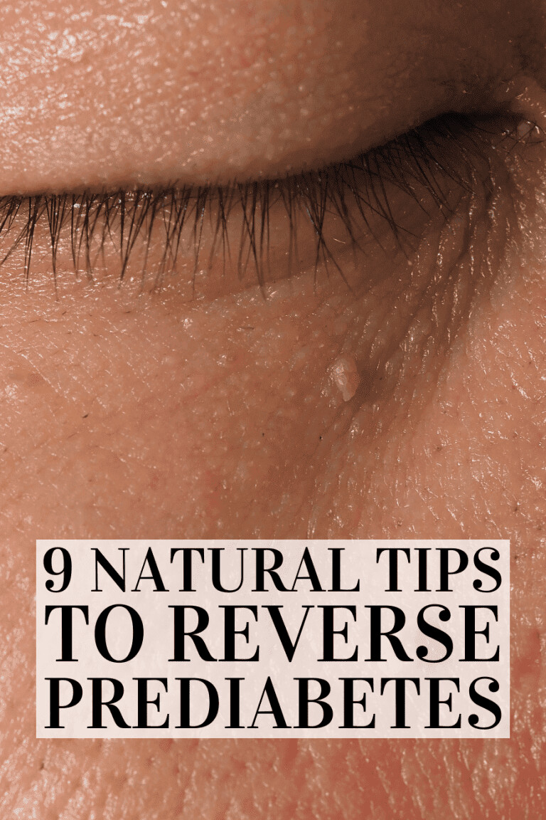 Reverse Prediabetes Naturally: 7 Proven Steps