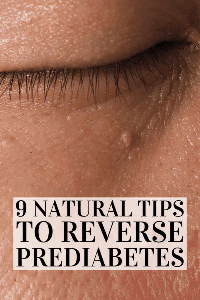 Reverse Prediabetes Naturally: 7 Proven Steps