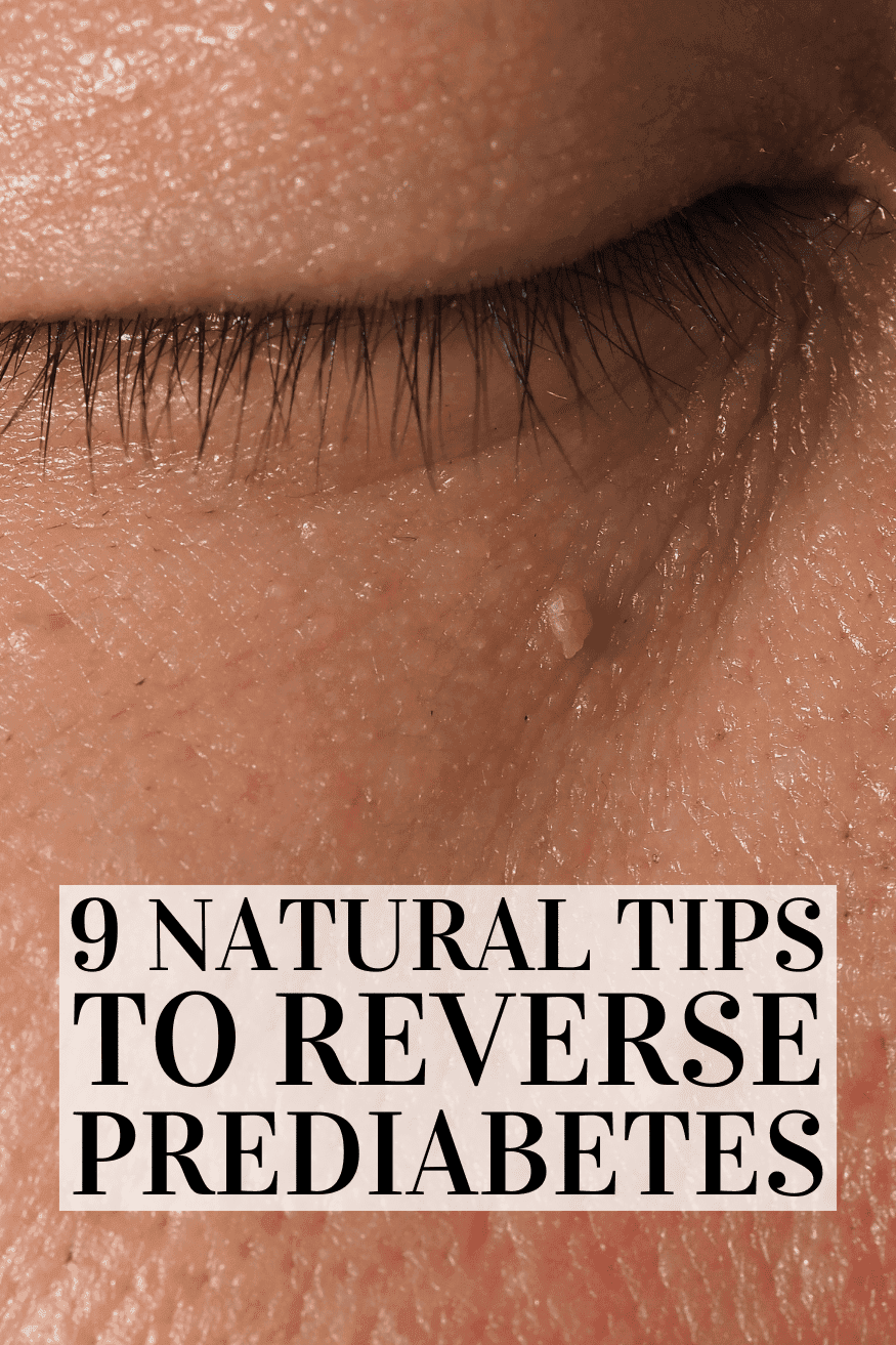 Read more about the article Reverse Prediabetes Naturally: 7 Proven Steps